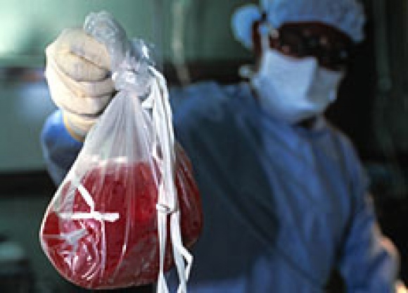Médicos são acusados de matar quatro pacientes para traficar órgãos