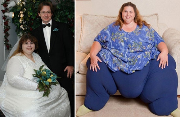 Ex reata com mulher mais obesa do mundo por saudade da vida sexual