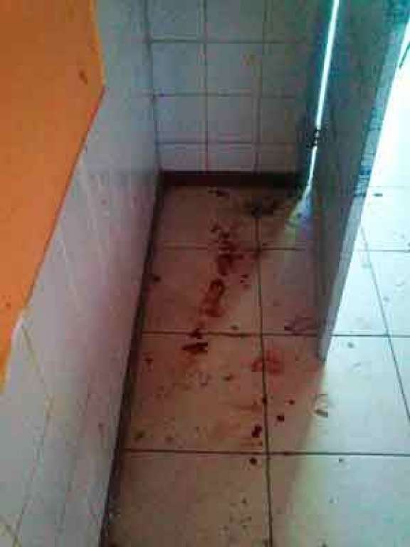 Após extração de balas, menor alvejado dentro de escola em Lauro de Freitas passa bem