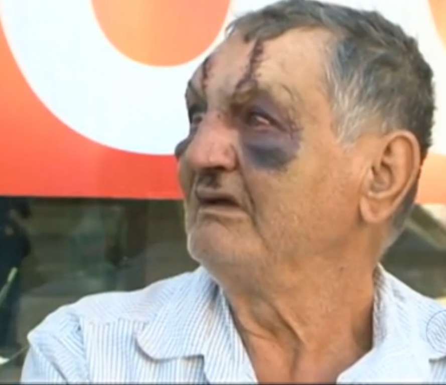 ‘Me enganaram’, diz idoso que teve rosto deformado após espancamento