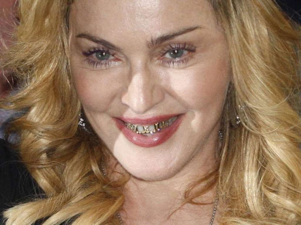 Madonna exibe dentes com ‘molduras douradas’ em evento