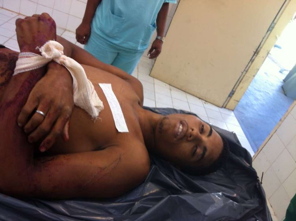 Camaçari:Tiroteio acaba com um morto no Parque das Mangabas