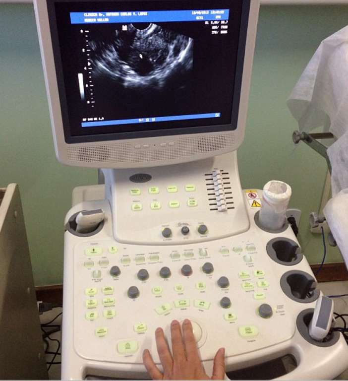 Xanddy posta foto de ultrassom e levanta suspeita de gravidez de Carla Perez