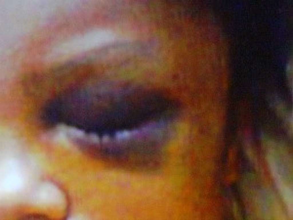 Violência: mulher agredida pelo marido fica sem falar e andar