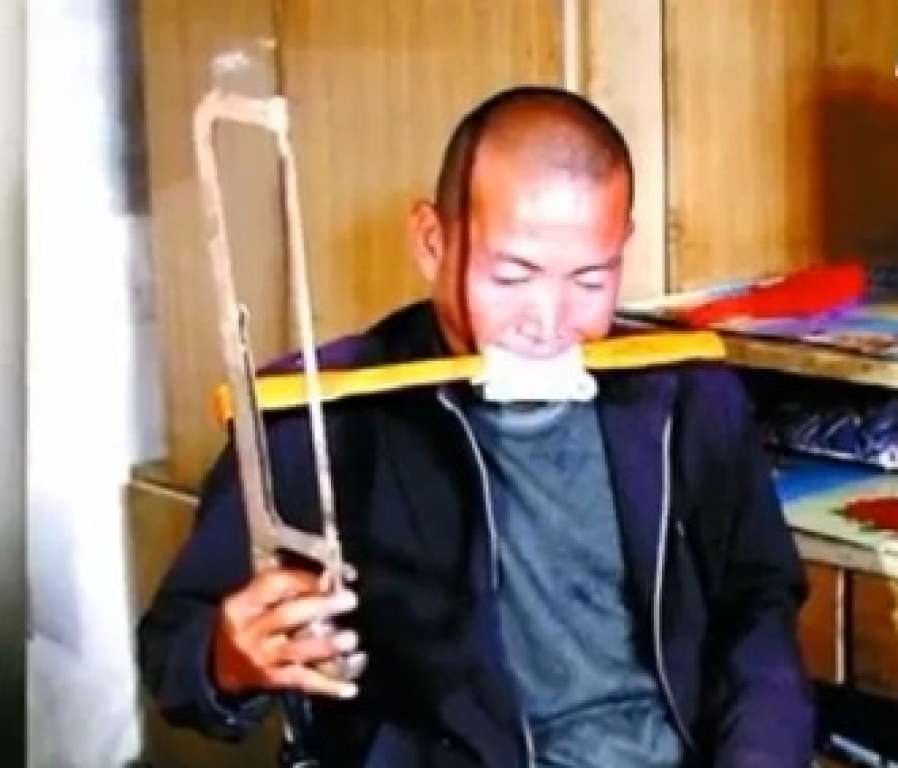 Sem dinheiro para cirurgia, chinês amputa sozinho a perna direita