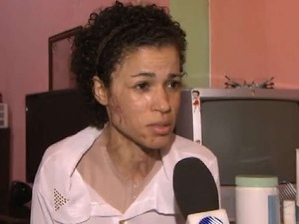 Mulher conta drama um ano após ser atingida por ácido na rua: ‘Quero viver’