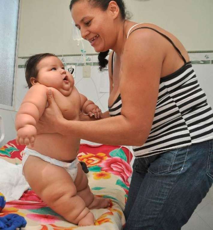 VEJA VÍDEO: Bebê que pesa 25 quilos inicia tratamento para emagrecer na Colômbia