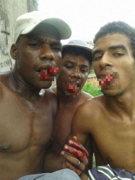 Traficantes fazem ladrões comerem os próprios dedos em Salvador