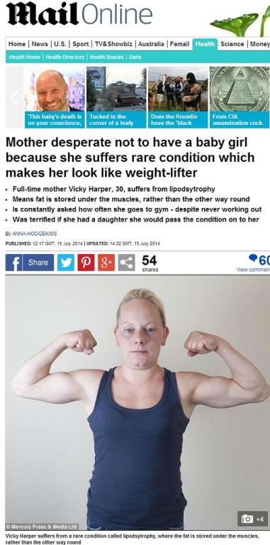 Por causa de doença, mulher tem corpo de atleta sem nunca ter malhado