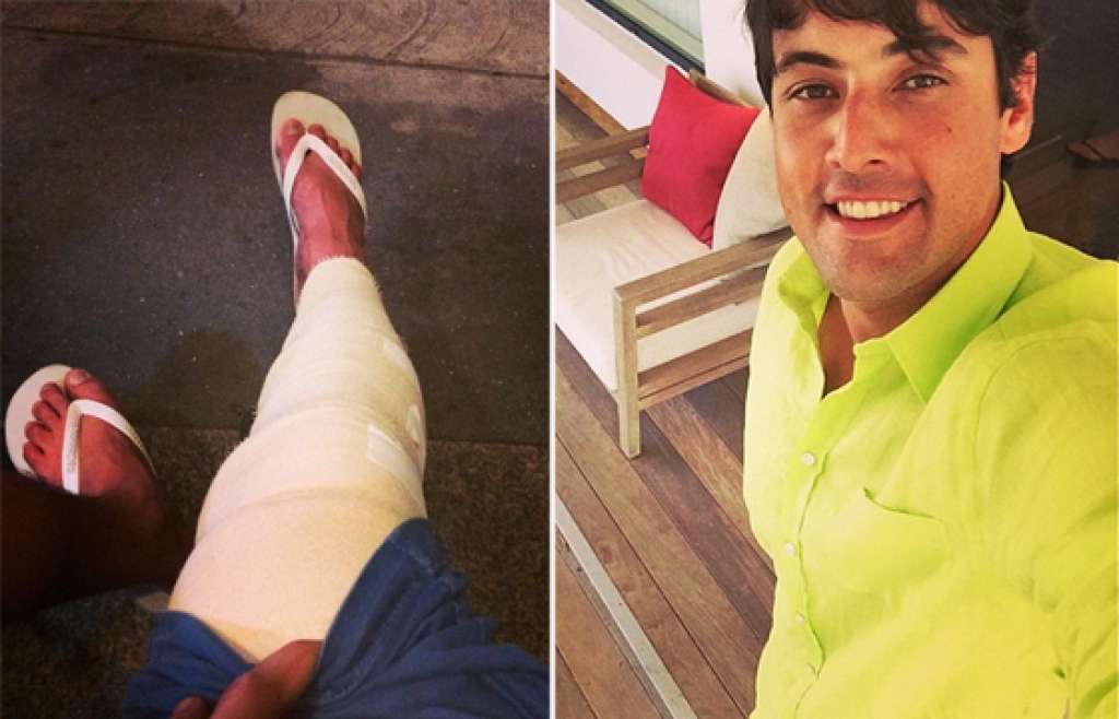 Bruno de Luca sofre acidente e rompe ligamentos do joelho