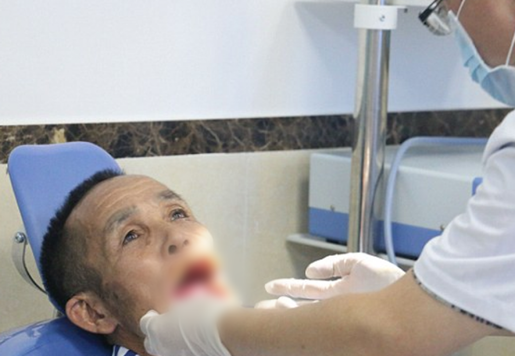 Homem que teve boca arrancada por lobo passa por cirurgia 56 anos depois