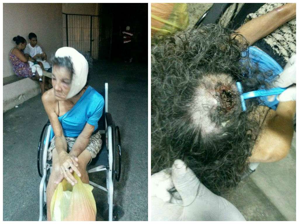 Salvador: com grave ferimento na cabeça, idosa não acha vaga em hospital