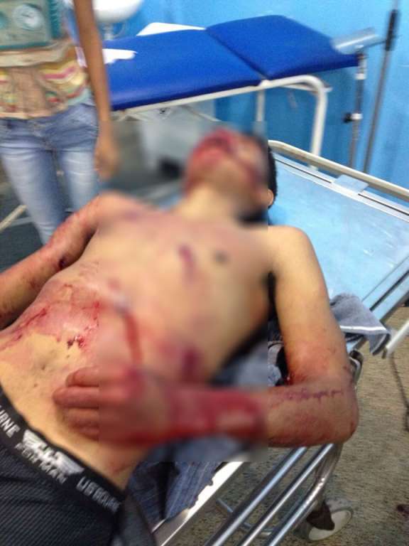Simões Filho: bandido morre e outro fica ferido em troca de tiros com a polícia