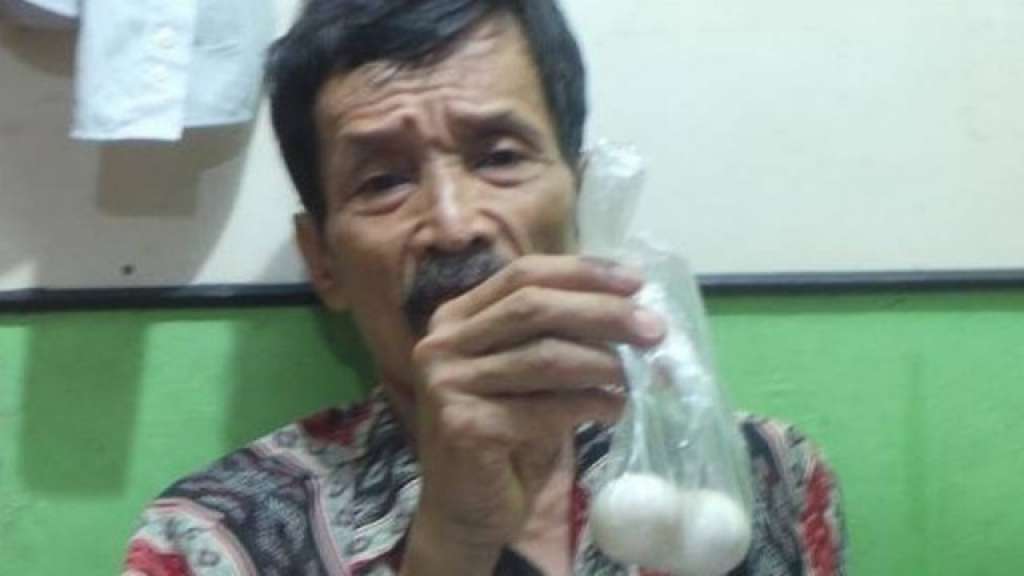 Indonésio vai a hospital e diz que botou ovos após sentir dor de estômago
