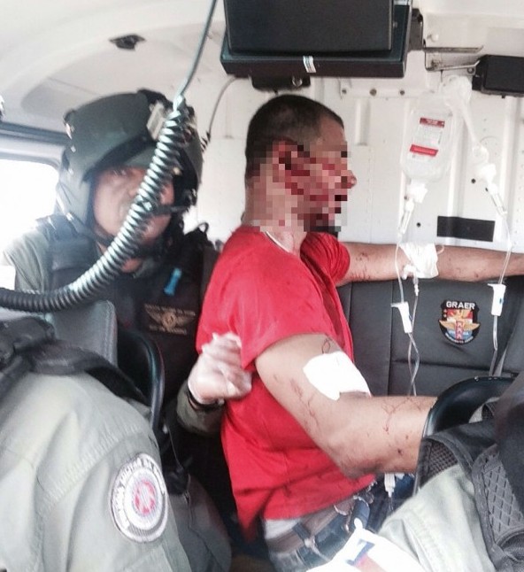 Policial militar é baleado na cabeça em Lauro de Freitas 