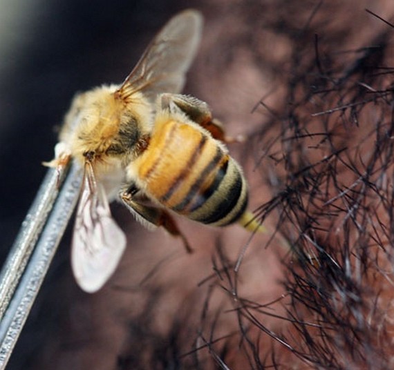 O veneno da abelha é conhecido por corromper as paredes celulares, incluindo de células cancerígenas, e tem sido alvo de estudo nos últimos anos. 