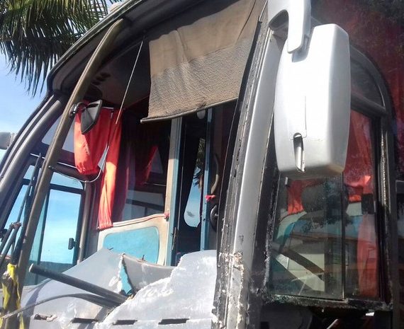 Motorista de ônibus teve fratura na perna no acidente (Foto: Renata Borges/ TV Santa Cruz) 