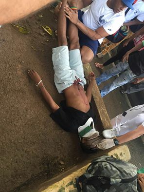 Jovem é atingido no peito após ser assaltado no Aquidabã