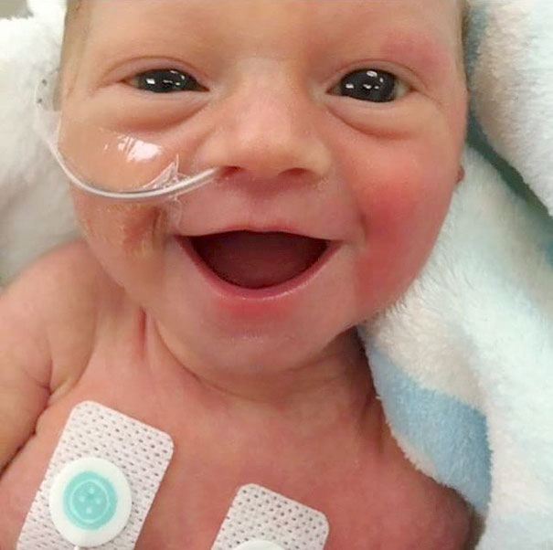 Sorriso de bebê prematuro encanta a Web