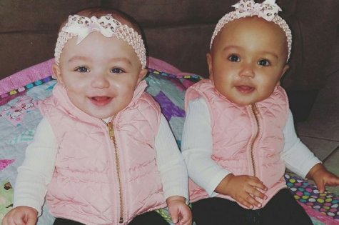 Gêmeas nascem com cor de pele diferente nos Estados Unidos