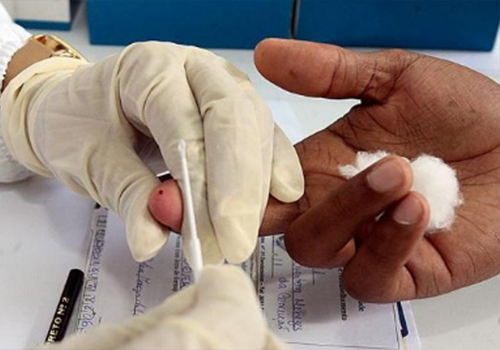 Testes rápidos identificam 29 casos de HIV durante Carnaval