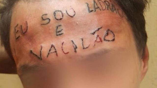 Campanha arrecada R$ 15 mil para remover tatuagem da testa de jovem