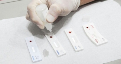 Até o fim de julho: Autoteste de HIV estará disponível nacionalmente em farmácias