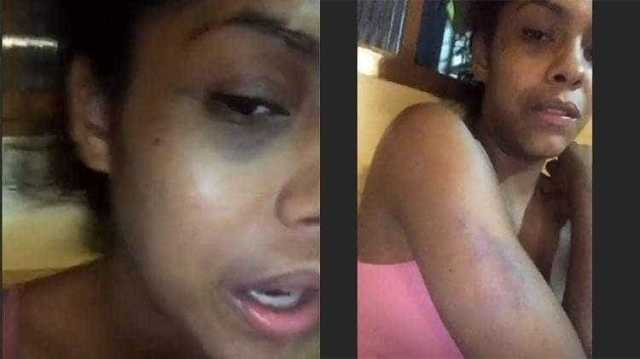 ‘Fui agredida por ser negra e beijar mulher’, diz modelo brasileira