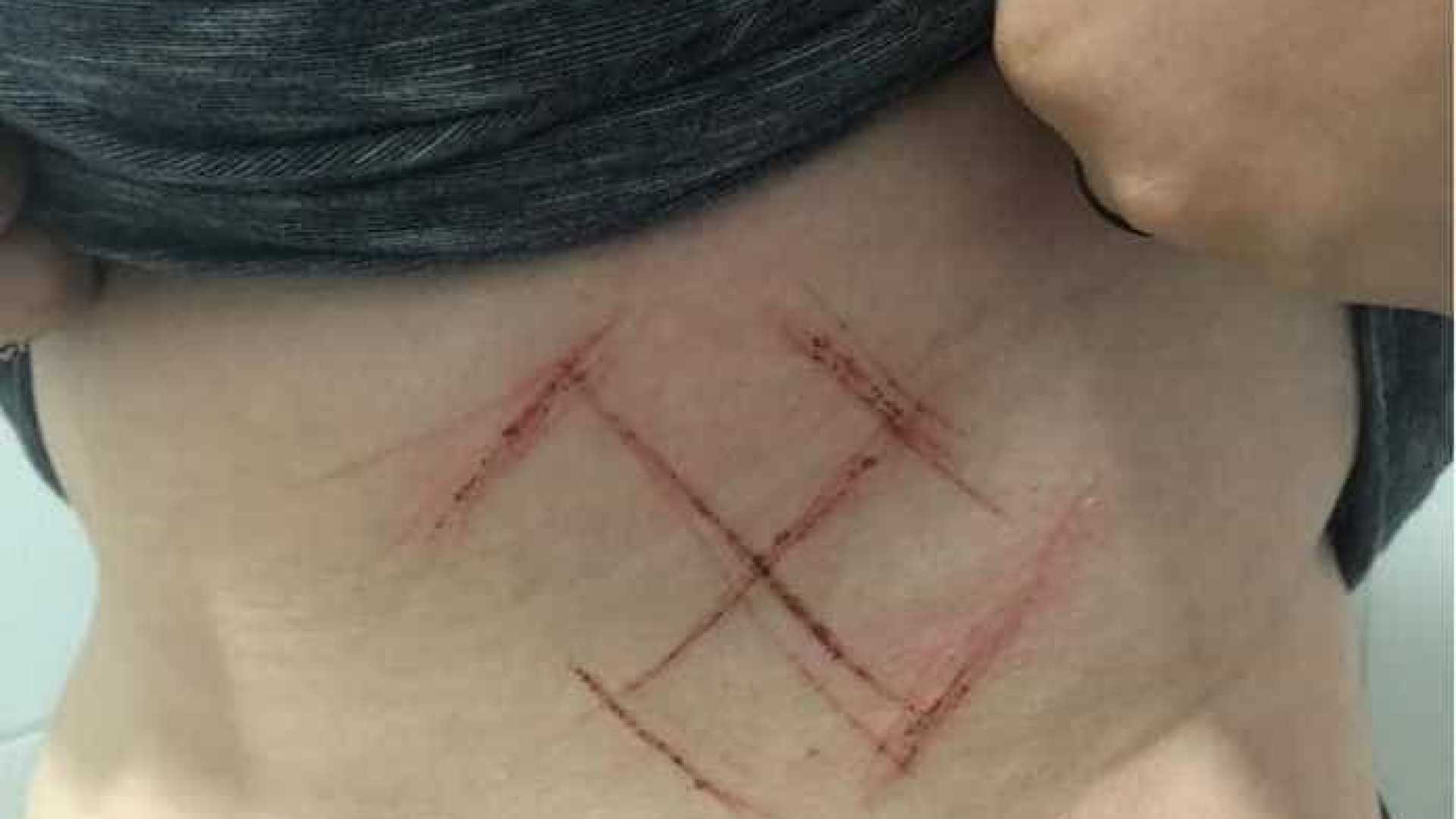 Jovem é espancada e tem suástica marcada na pele por usar adesivo do #EleNão