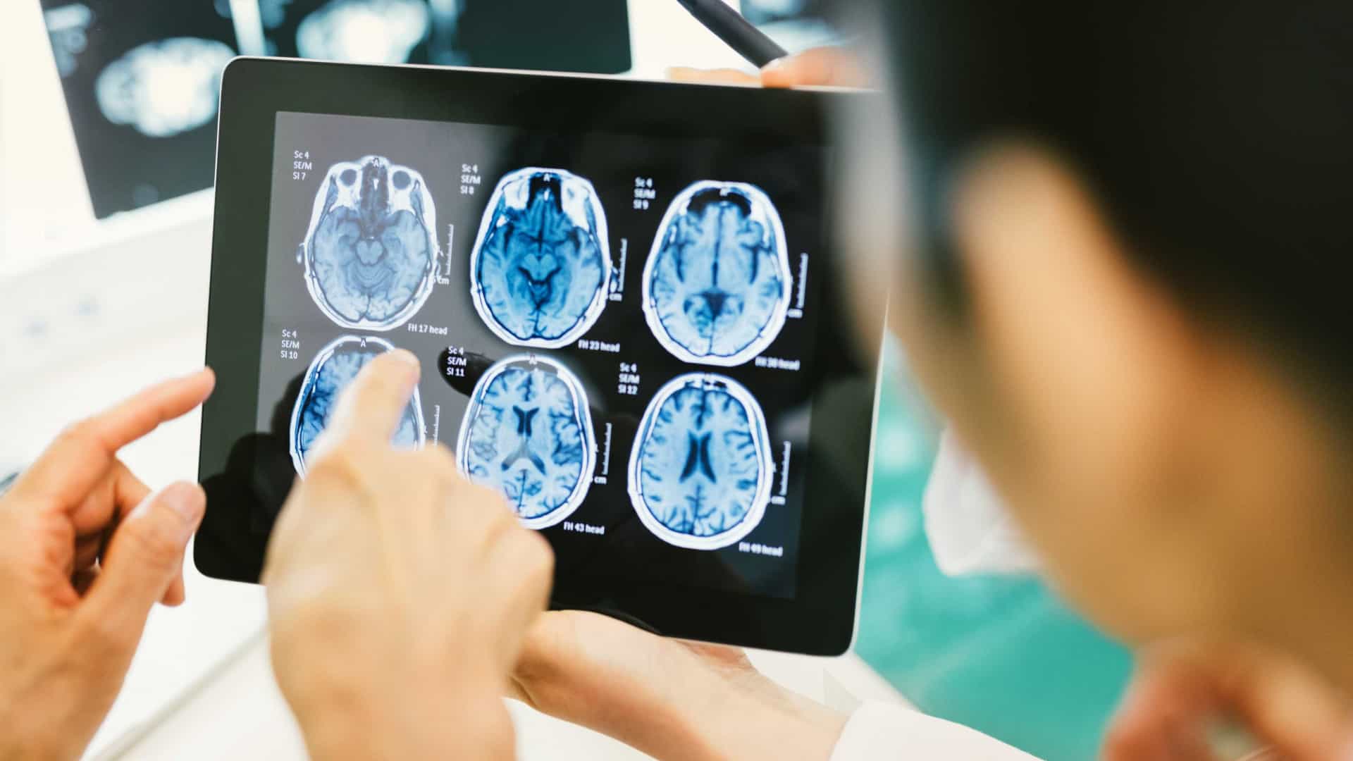 Cérebro pode ser treinado para curar doenças, diz estudo