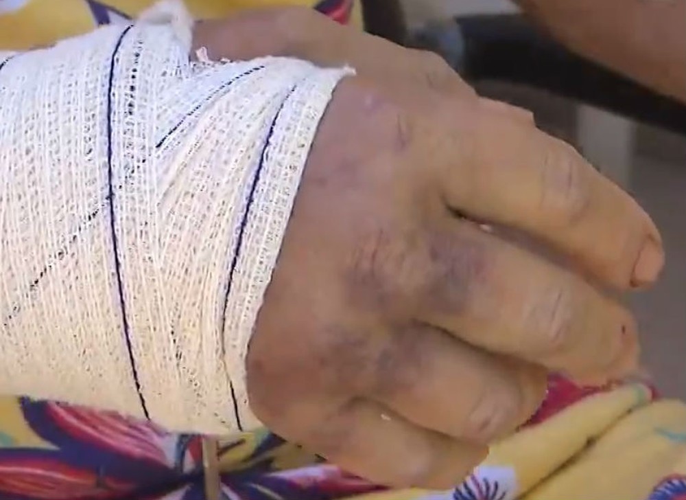 Idosa de 68 anos é espancada durante assalto em Salvador