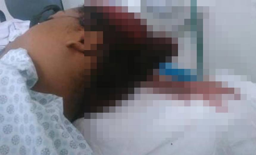 Jovem baleada acidentalmente em Camaçari aguarda regulação no HGC