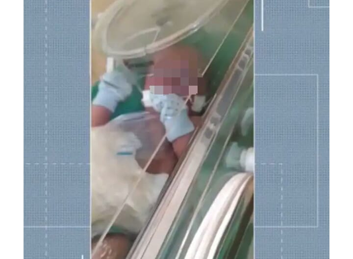 Recém-nascido aguarda cirurgia há 17 dias em Juazeiro