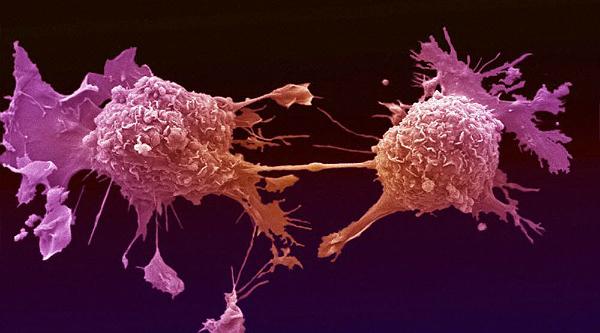 Criação de câncer, para pesquisar sinais precoces da doença, é projeta por cientistas