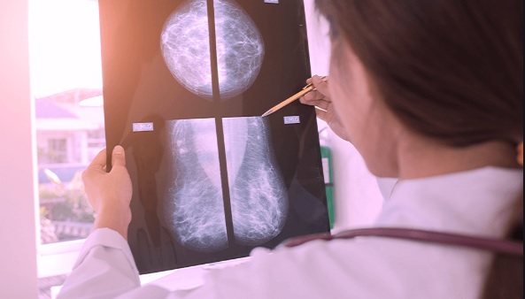 ‘Prevenir é o caminho’, em Camaçari 7.695 pacientes passaram ou estão em tratamento do câncer de mama
