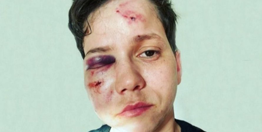 Youtuber Karol Eller começou briga por ciúmes da namorada, diz polícia
