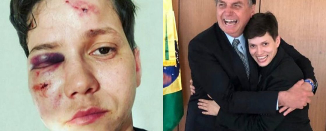 Após agressão homofóbica, youtuber bolsonarista presta depoimento no Rio