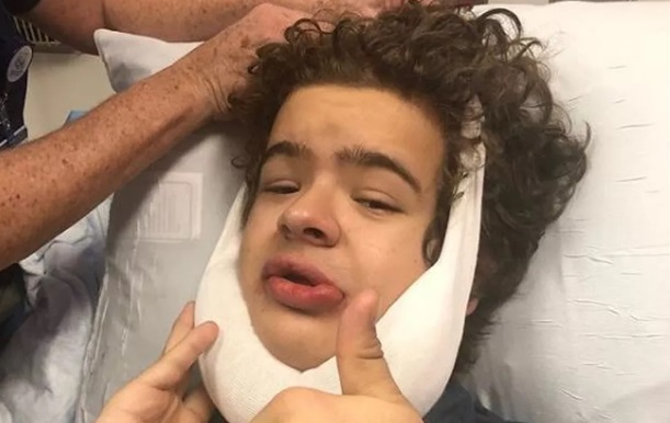 Ator de ‘Stranger Things’ passa por cirurgia para tratar síndrome genética rara