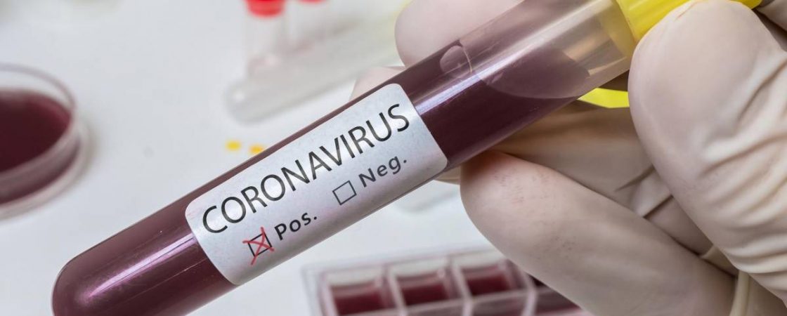 Coronavírus: Rio de Janeiro registra o primeiro paciente em estado grave