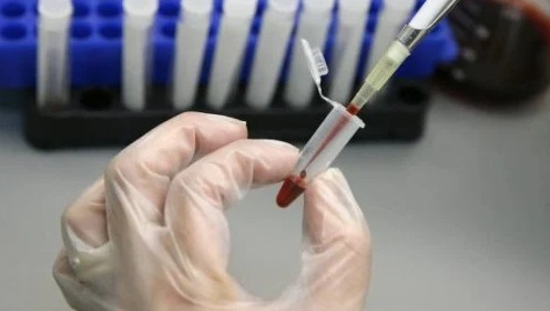 HIV: estudo sugere que segundo paciente foi curado do vírus