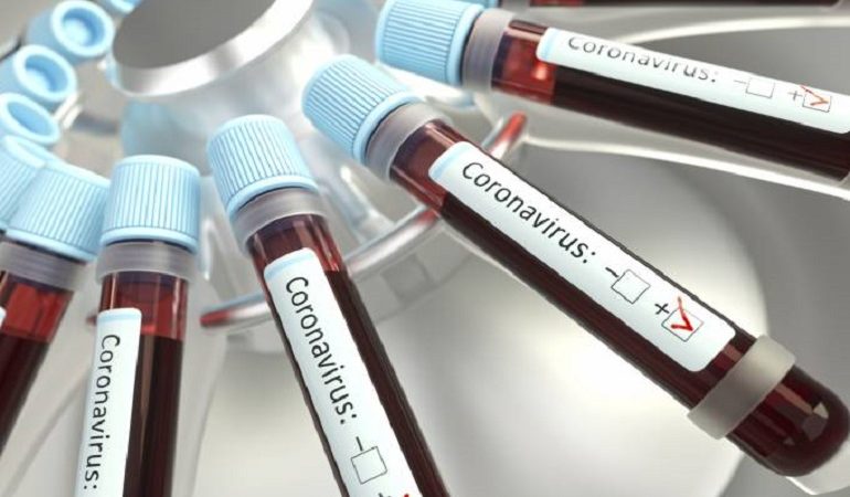 Casos confirmados de coronavírus na Bahia sobem para 127