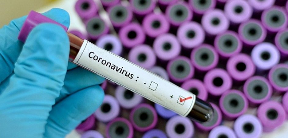 Coronavírus: Bahia registra 104 casos confirmados em boletim atualizado nesta quinta (26)
