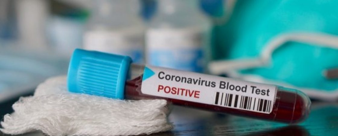 Número de infectados por coronavírus sobe para 156 na Bahia