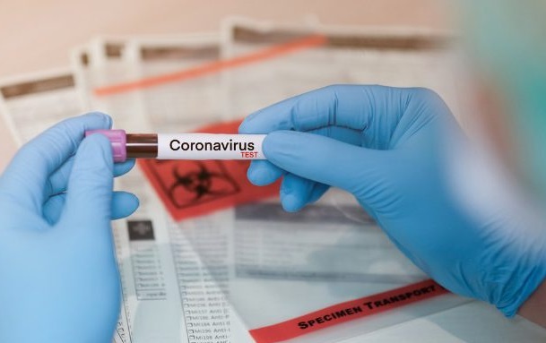 Coronavírus: testes podem levar de 15 minutos a 7 dias