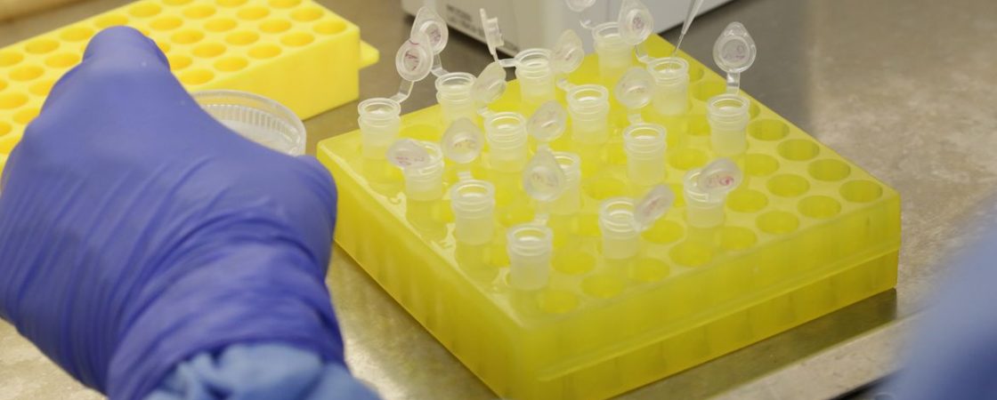 Sesab divulga novo boletim sobre o coronavírus; 11 municípios já foram notificados
