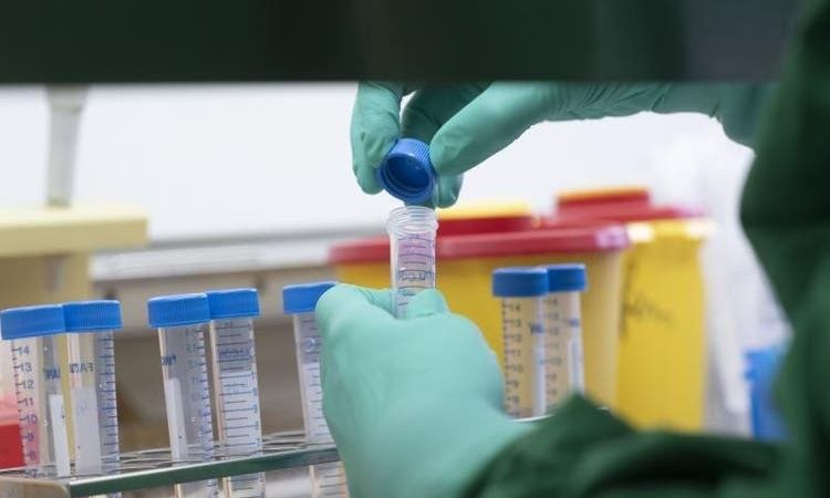 Primeira pessoa diagnosticada com coronavírus em Camaçari está curada