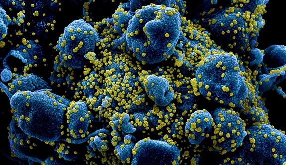 Japão anuncia ter encontrado variante do coronavírus em pessoas que estiveram no Brasil