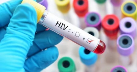 HIV: pesquisa brasileira aponta suposto tratamento que pode eliminar o vírus