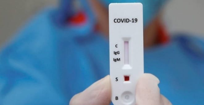 ANS decide que convênios têm de cobrir teste sorológico para Covid-19