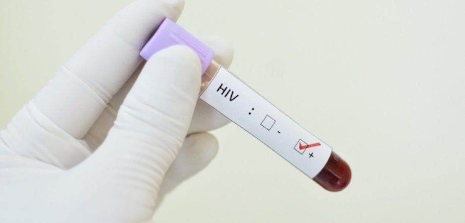 HIV: Sesau chama atenção para o ‘Dezembro Vermelho’; em 2020 já foram registrados 90 novos casos em Camaçari